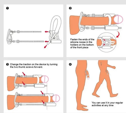 Safe & Comfortable Male Enhancement Penis Extender Kit for Length & Girth Growth